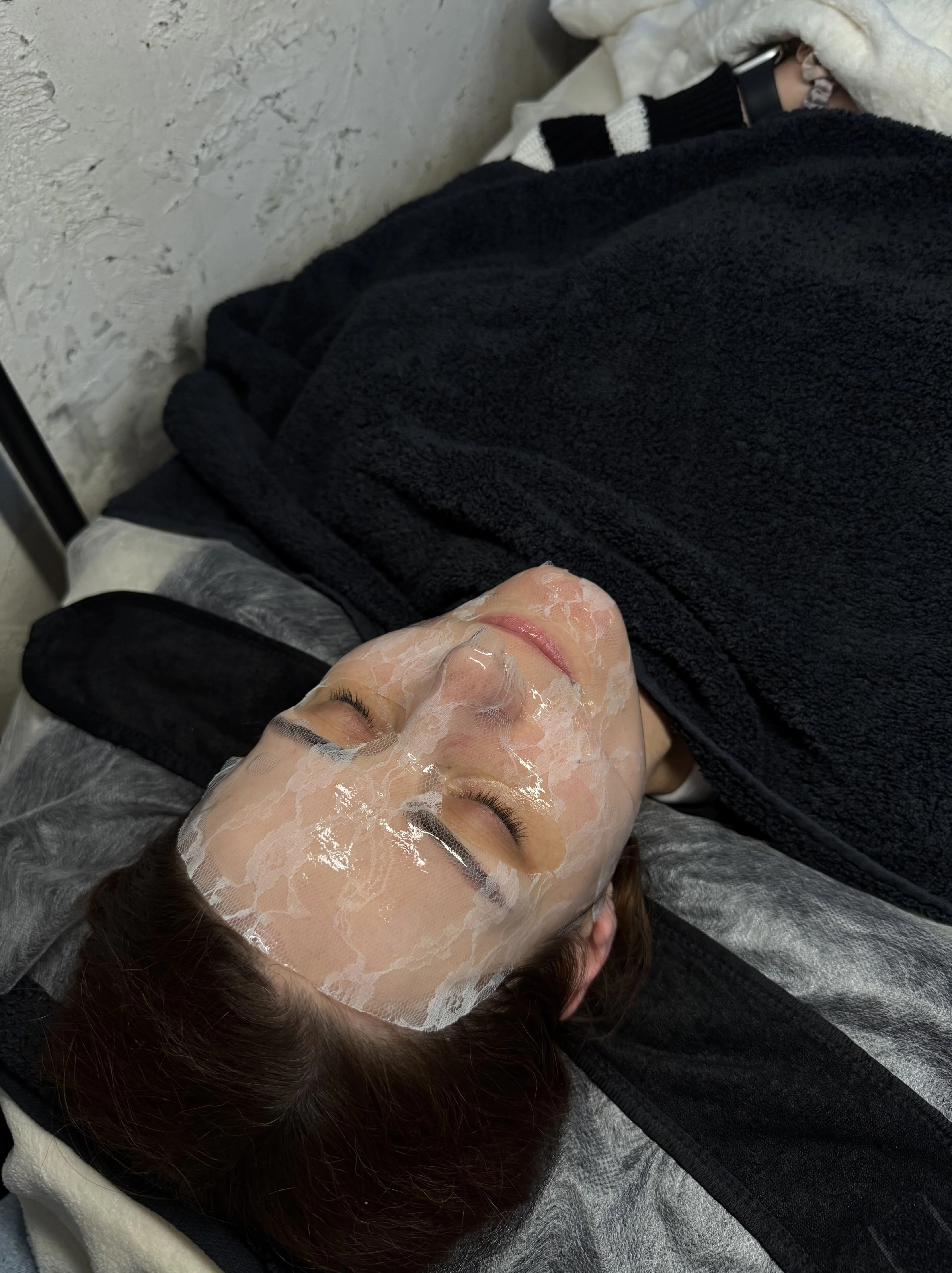 Lha lala peeling